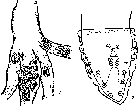  Abbreviata (Abbreviata) skrjabini Markov, Ivanov, Nikulin et Tchernobai, 1962 (по Маркову, Иванову, Никулину и Чернобай, 1962)