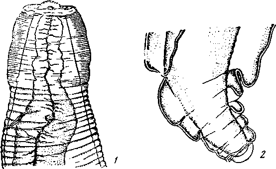 Physaloptera (Physaloptera) limbata Leidy, 1856 (по Моргану, 1946)