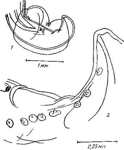 Physaloptera (Pseudophysaloptera) riukiuana Lincicome et McConnaughey, 1948 (по Круцу, 1950)