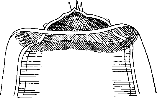 Physaloptera pyramidalis Linstow, 1879 (по Линстову, 1879)
