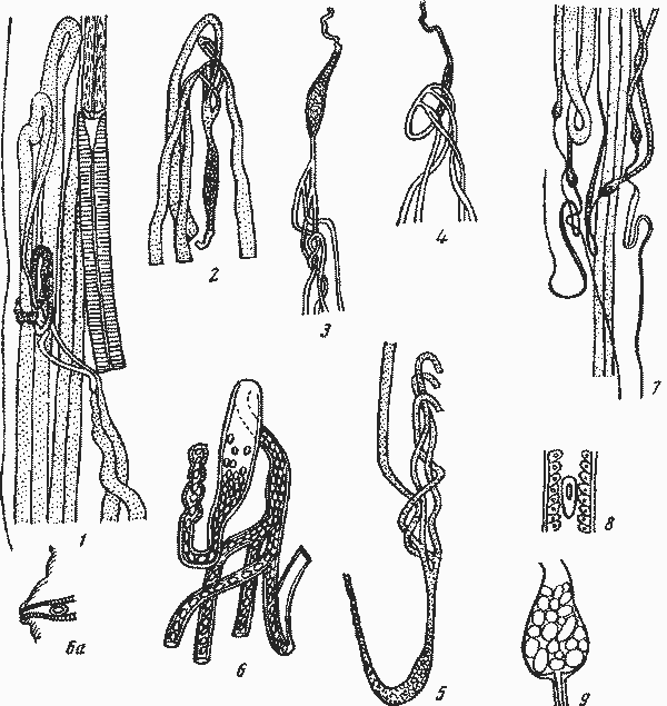 Abbreviata (Abbreviata) antarctica (Linstow, 1899) typica (Irwin-Smitli, 1922) (по Ирвин-Смит, 1922)