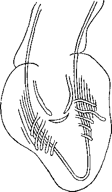 Cyrnea (Linstow, 1907) Yorke et Maplestone, 1926 (по Линстову, 1907)