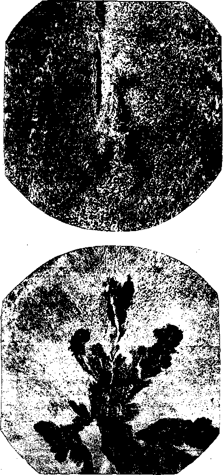 Драшейоз желудка (по Горшкову, 1946)
