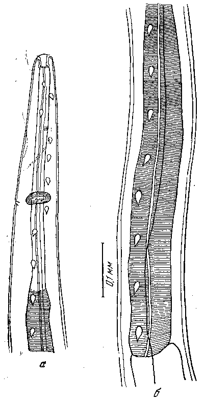 Tetrameres (Tetrameres) grusi Shumakowitsch, 1946 (по Шумаковичу, 1946)
