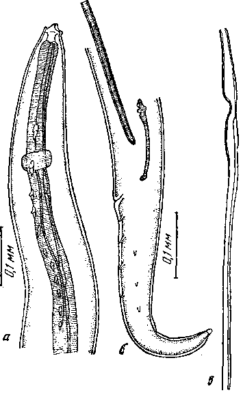 Tetrameres (Tetrameres) oxylabiatus Oschmarin, 1956 (по Ошмарину, 1956)