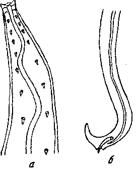 Tetrameres (Tetrameres) skrjabini Panowa, 1926 (по Васильковой, 1927)