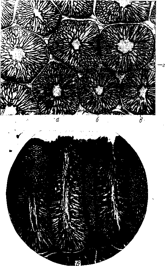 Tetrameres (Petrowimeres) fissispina (Diesong, 1861) (по Цветаевой, 1960)