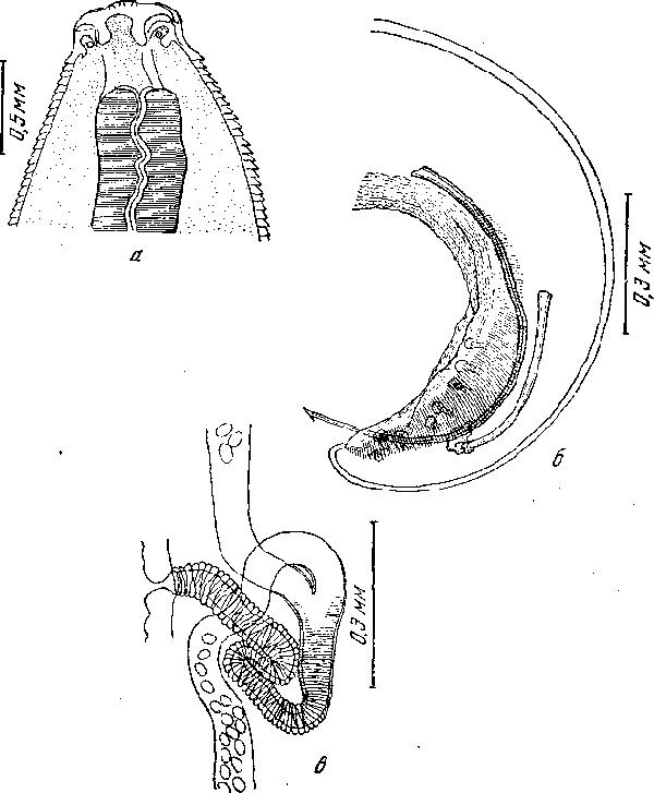 Cyrnea (Procyrnea) excisiformis Yamaguti, 1935 (по Ямагути, 1935)