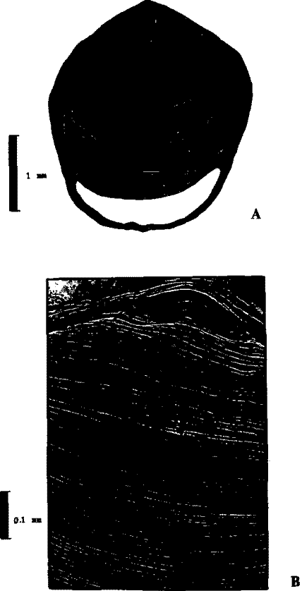 Berryteuthis magister, поперечный срез а передней части конуса, видны слои нарастания гипостракума, заполняющие внутренний объем конуса
