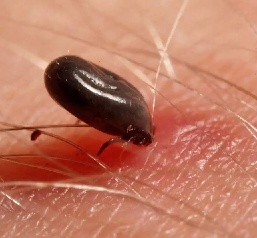 Литература по вопросам системы клещ-возбудитель. Часть 35 Литература по вопросам системы клещ-возбудитель. Часть 35