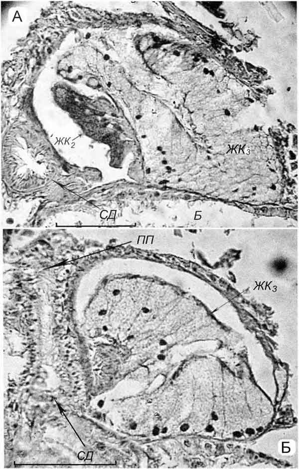 Cincinna macrostoma (Steenbuch) (D 6,1 мм; 26.07.2004): поперечные срезы через дистальные участки капсульной железы