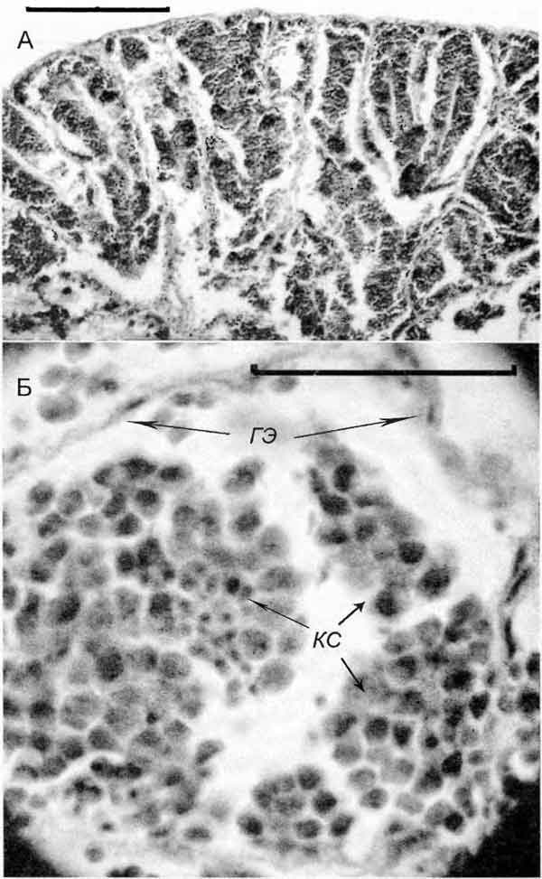 Lithoglyphus naticoides