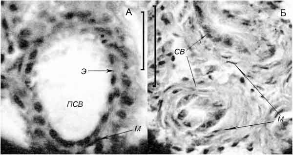 Lithoglyphus naticoides