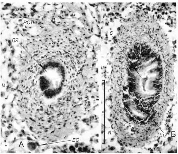 Lithoglyphus naticoides Lithoglyphus naticoides