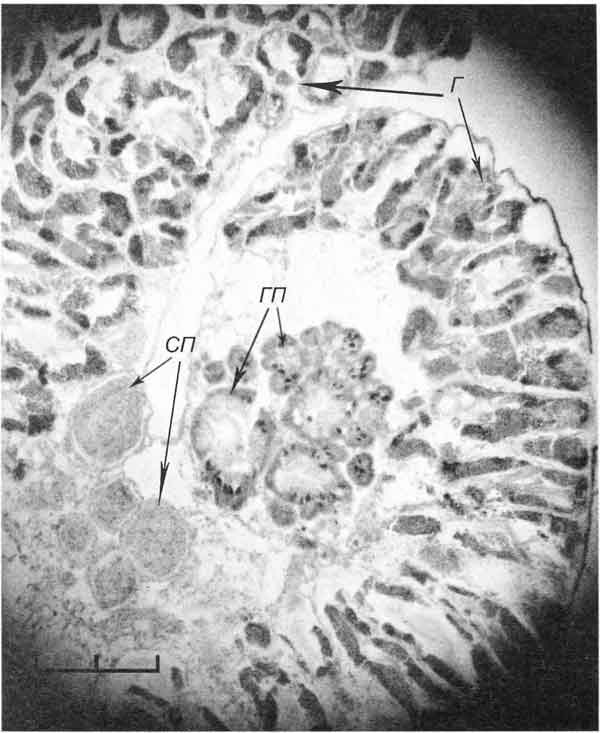 Bithynia tentaculata Bithynia tentaculata