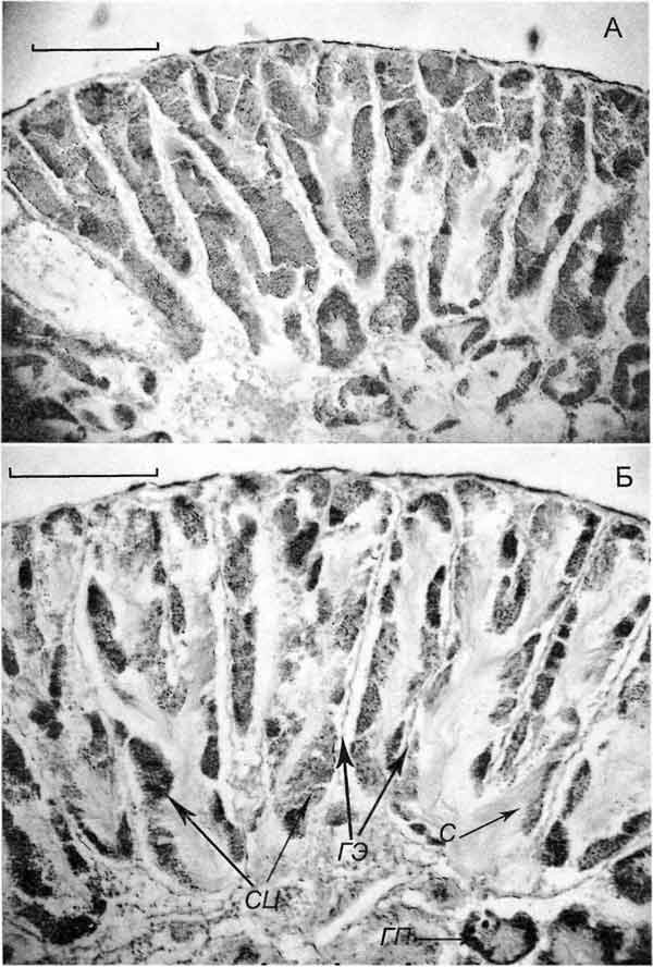Bithynia tentaculata