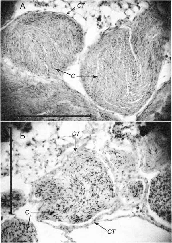 Bithynia tentaculata Bithynia tentaculata