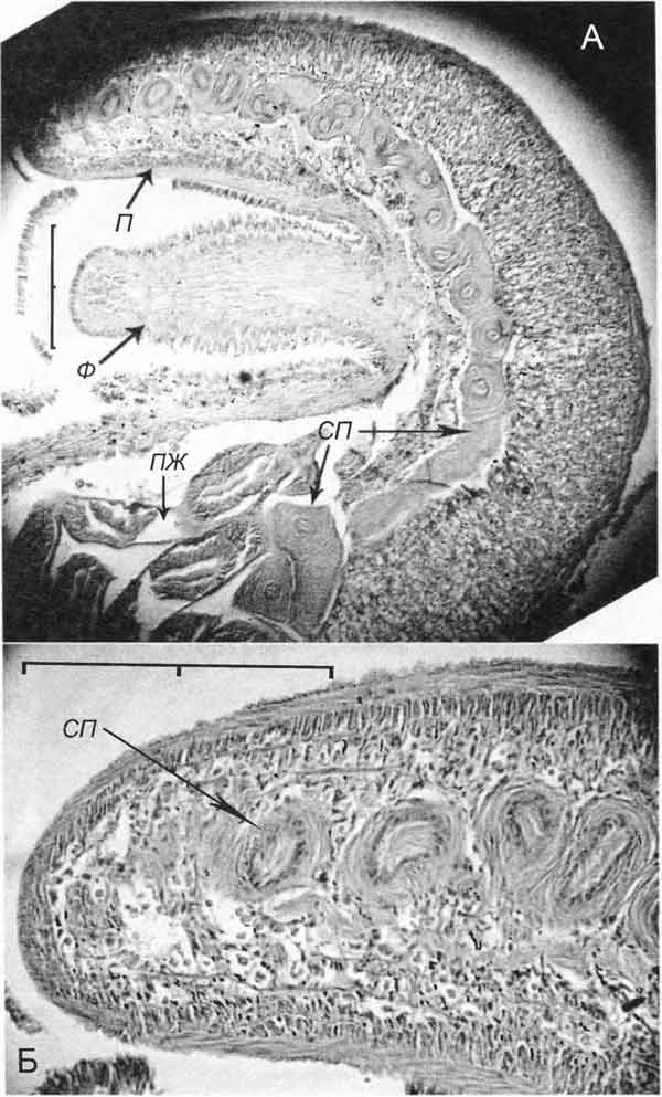 Bithynia tentaculata