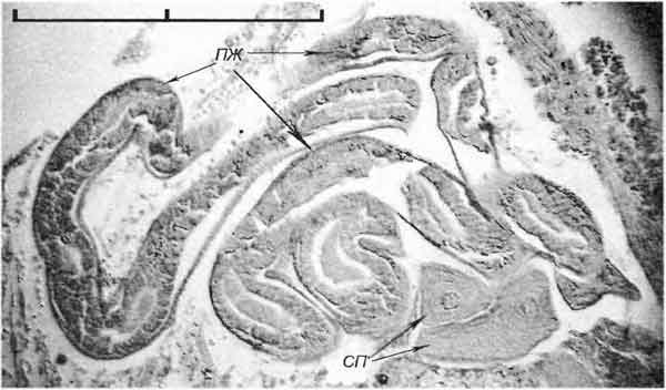 Bithynia tentaculata