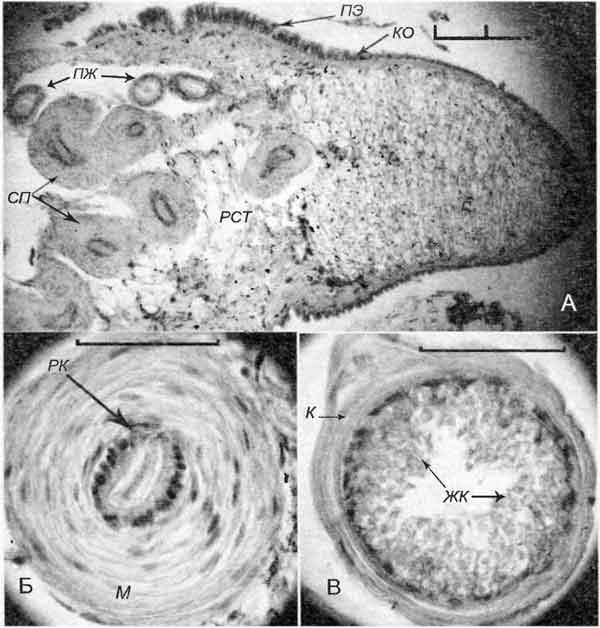 Bithynia tentaculata