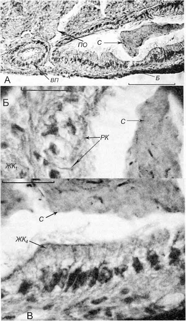 Bithynia tentaculata Bithynia tentaculata