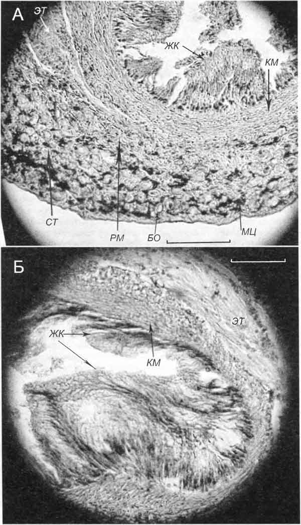 Contectiana contecta (Millet) (H 26,1 мм (А) и H 25,4 мм (Б); 27.05.2009): фрагменты поперечных срезов через средние участки копулятивного аппарата Contectiana contecta (Millet) (H 26,1 мм (А) и H 25,4 мм (Б); 27.05.2009): фрагменты поперечных срезов через средние участки копулятивного аппарата