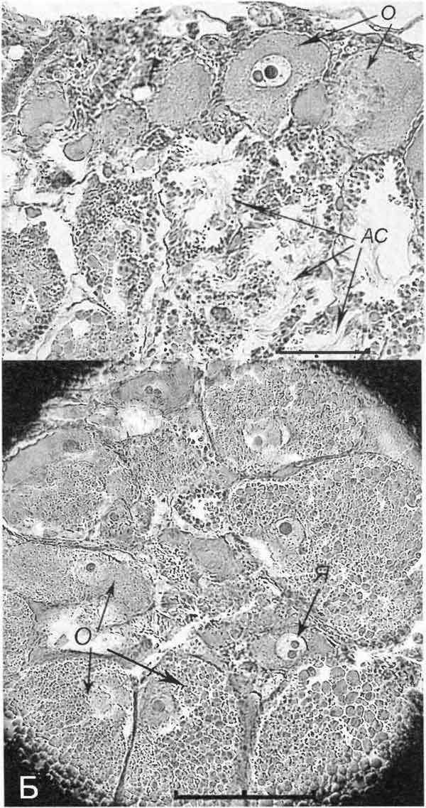 Cincinna macrostoma (Steenbuch): срезы через гермафродитную железу