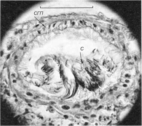Cincinna macrostoma (Steenbuch) (D 6,1 мм; 26.07.2004): поперечный срез через гермафродитный проток Cincinna macrostoma (Steenbuch) (D 6,1 мм; 26.07.2004): поперечный срез через гермафродитный проток