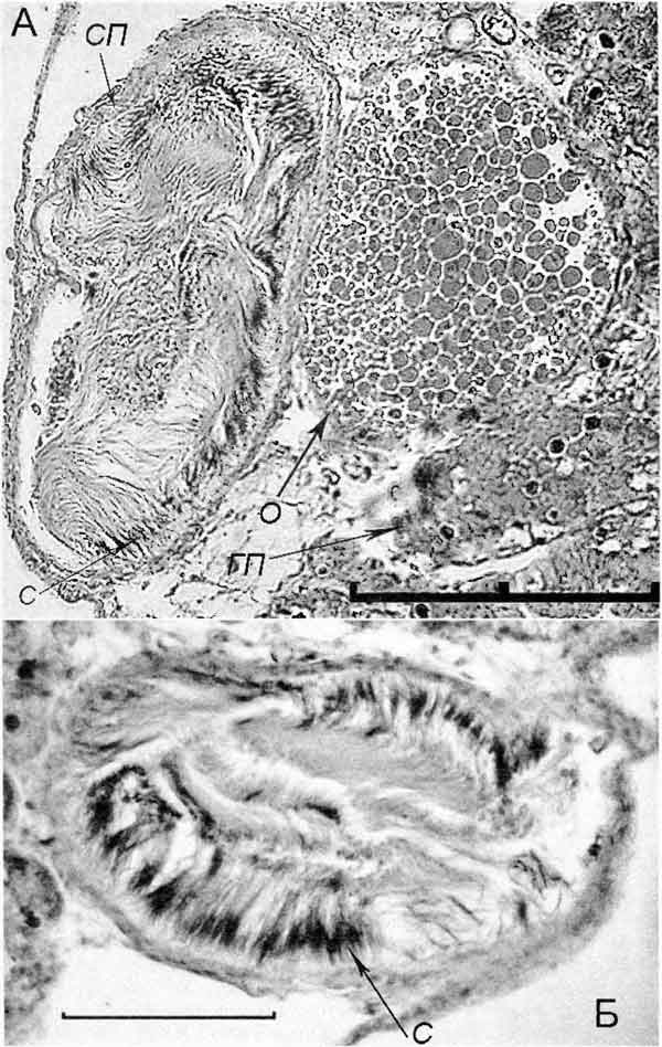 Cincinna macrostoma (Steenbuch) (A - D 6,1 мм; 26.07.2004; Б - D 6,0 мм; 26.07.2004): поперечные срезы через семенной пузырек Cincinna macrostoma (Steenbuch) (A - D 6,1 мм; 26.07.2004; Б - D 6,0 мм; 26.07.2004): поперечные срезы через семенной пузырек
