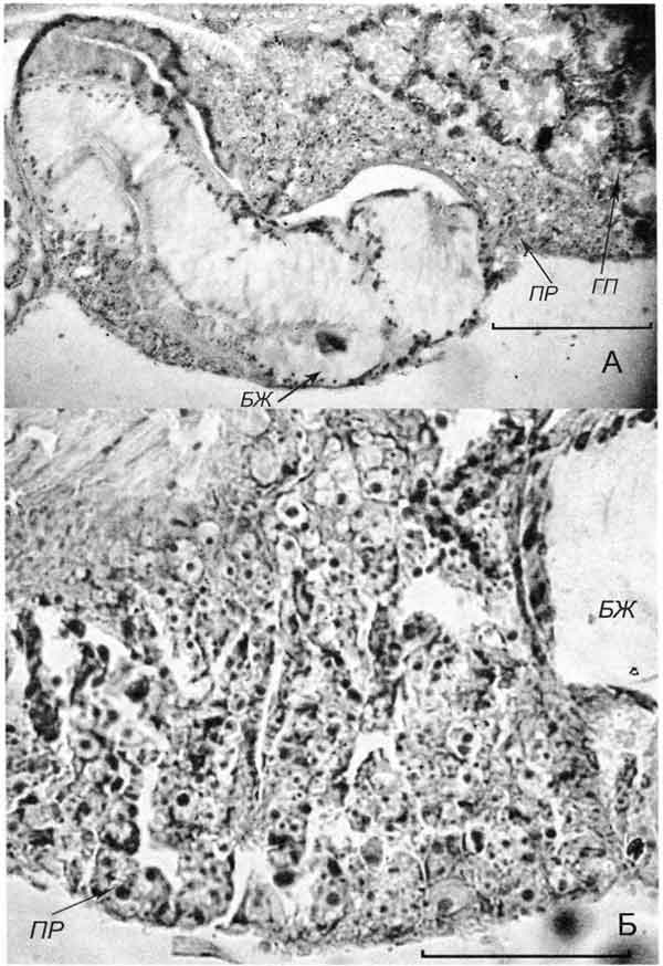 Cincinna macrostoma (Steenbuch) (D 6,0 мм; 18.07.2005): поперечные срезы через проксимальный (А) и средний (Б) участки простаты
