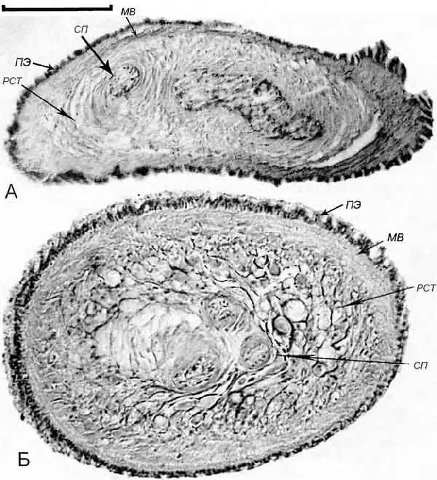 Cincinna macrostoma (Steenbuch) (A D 6,0 мм, Б - D 5,8 мм; 18.07.2005): косой (А) и поперечный (Б) срезы через разные участки копулятивного аппарата Cincinna macrostoma (Steenbuch) (A D 6,0 мм, Б - D 5,8 мм; 18.07.2005): косой (А) и поперечный (Б) срезы через разные участки копулятивного аппарата