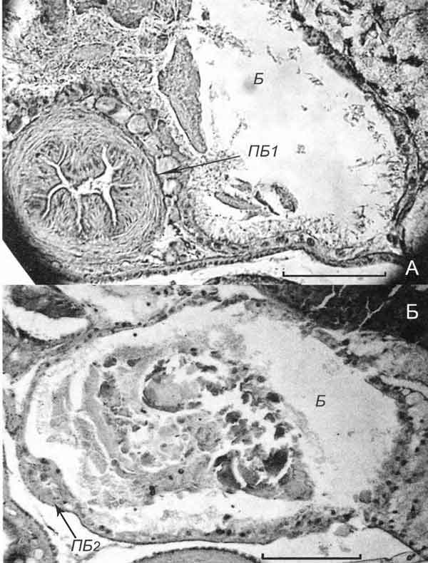 Cincinna macrostoma (Steenbuch) (D 6,1 мм; 26.07.2004): поперечные срезы через дистальный (А) и основной (Б) участки бурсы Cincinna macrostoma (Steenbuch) (D 6,1 мм; 26.07.2004): поперечные срезы через дистальный (А) и основной (Б) участки бурсы