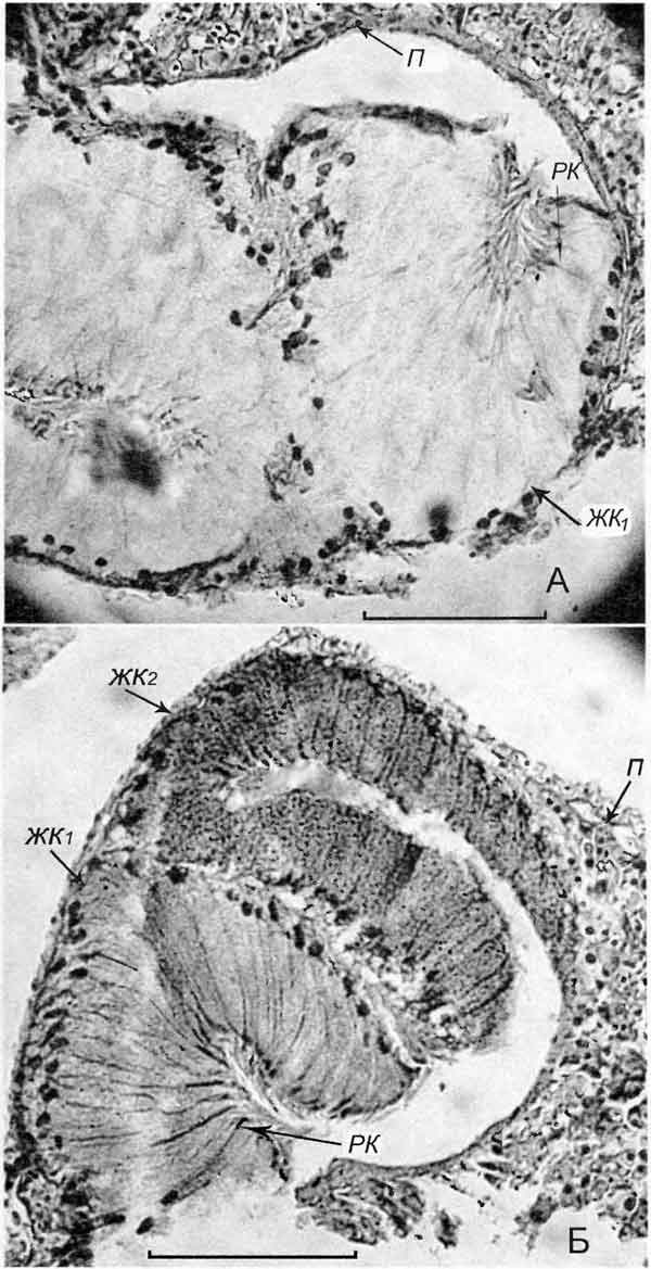 Cincinna macrostoma (Steenbuch) (D 6,1 мм, 26.07.2004): А и Б - поперечные срезы через два канала петли капсульной железы