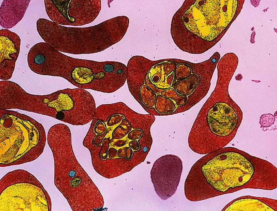 Представитель класса споровиков — малярийный плазмодий (Plasmodium vivax) Представитель класса споровиков — малярийный плазмодий (Plasmodium vivax)