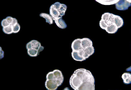 Отряд раковинные амебы (Testacea)