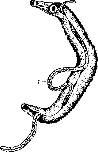 Кровяная двуустка Schistosoma haematobium
