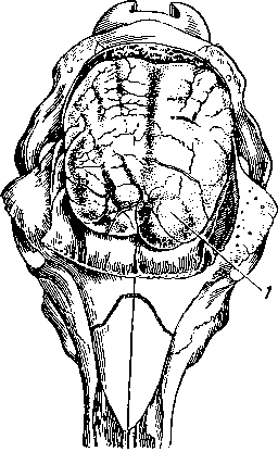 Мозг овцы, пораженный ценурусом Multiceps multiceps