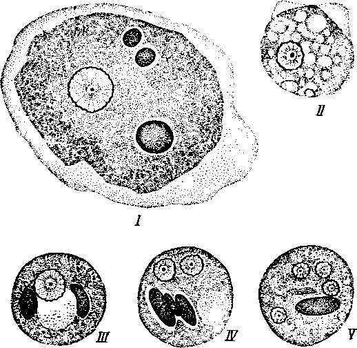 Entamoeba histolytica