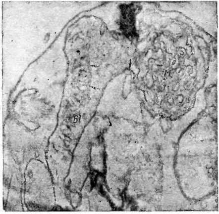 Электронная микрофотография участка тела Trypanosoma cruzi