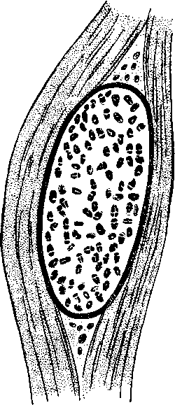 Циста Myxobolus pfeiferi, лежащая между мускульными клетками окуня