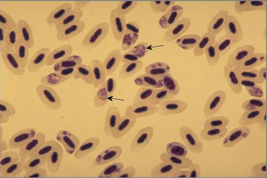 Стадия бесполого размножения Plasmodium