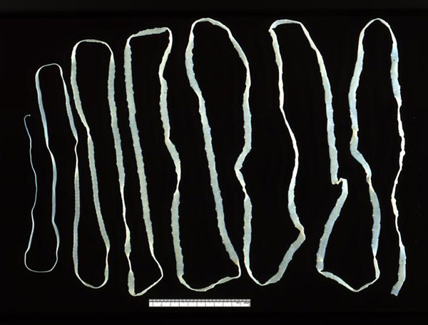 Представитель класса цестод — бычий солитер (Taeniarhynchus saginatus)