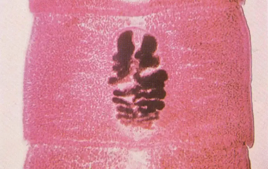 Циклы развития некоторых других представителей класса цестод Циклы развития некоторых других представителей класса цестод