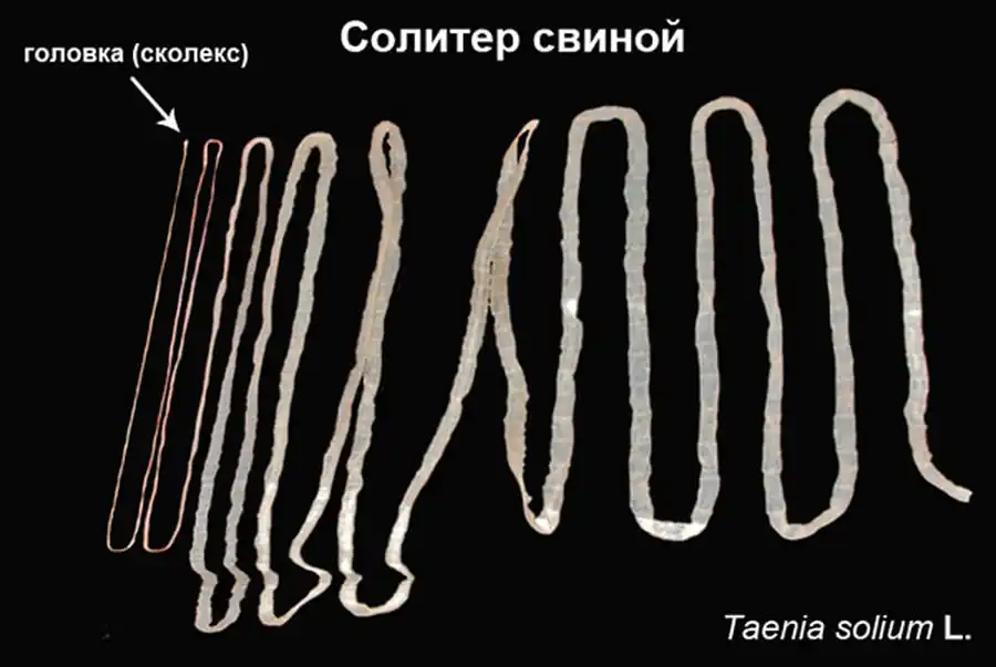 Нервная, пищеварительная и выделительная системы цестод