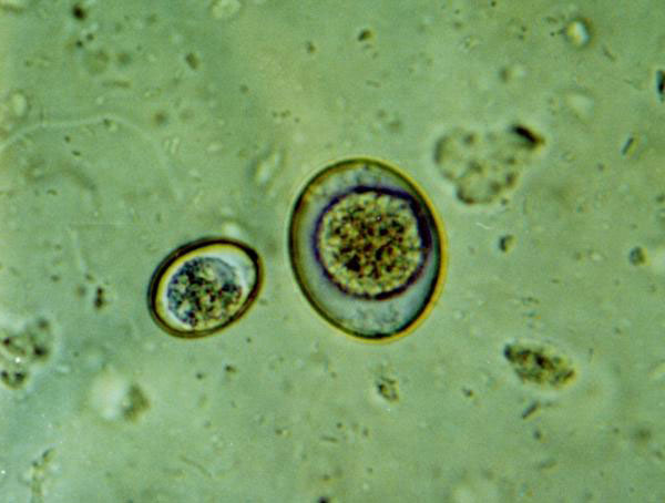 Подкласс Телоспоридии (Telosporidia)