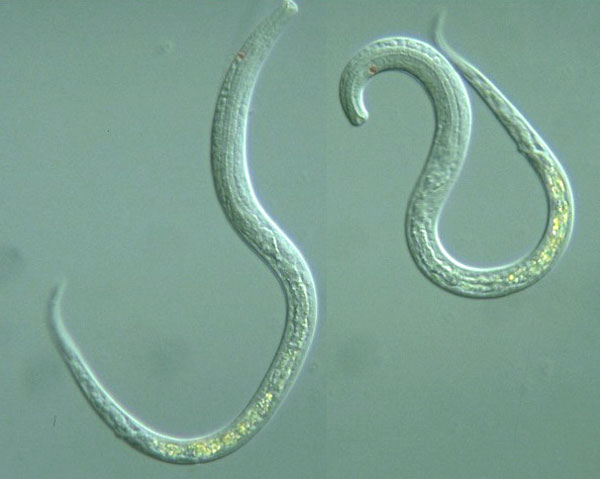 Класс Собственно круглые черви, или Нематоды (Nematoda)