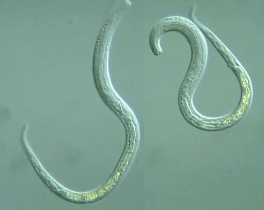 Класс Собственно круглые черви, или Нематоды (Nematoda)