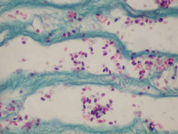 Подкласс Книдоспоридии (Cnidosporidia)