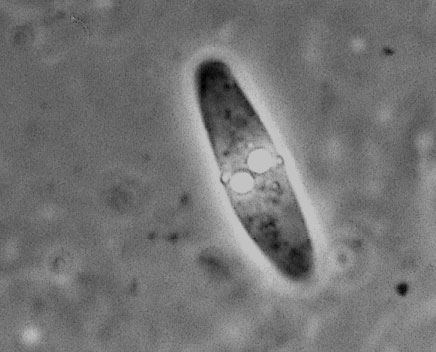 Отряд Актиномиксидии (Actinomyxidia)