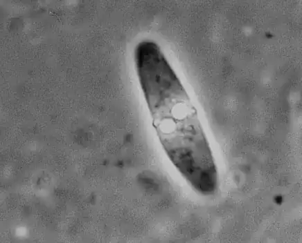 Отряд Актиномиксидии (Actinomyxidia)